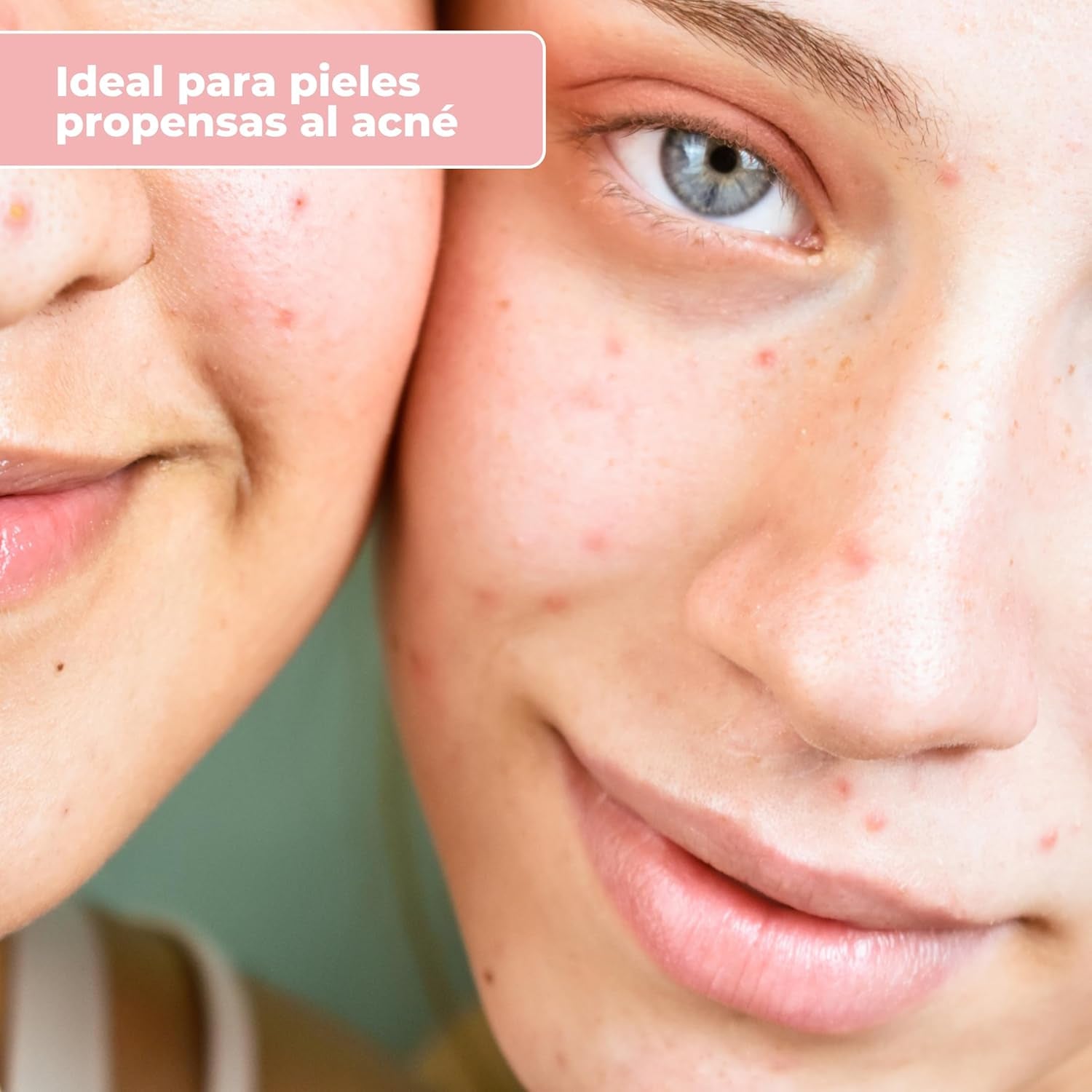 Babaria - Serum Facial Microbiota Con Acido Hialuronico | Defensa De La Piel Con Acido Hialuronico | Serum Facial Mujer Y Hombre 30Ml | Antiarrugas Mujer Y Hombre